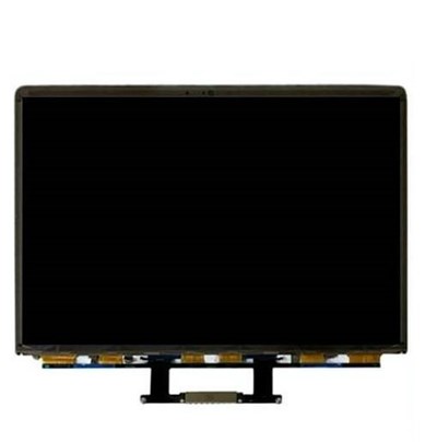 Màn thông dụng - tiết kiệm chi phí, được nhiều người chọn